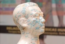 ¿Qué es la acupuntura? acupuntura