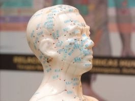 acupuntura