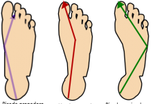 La mejor zapatilla de running para ti Tipo de pisada. Correr