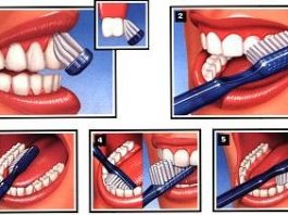 Técnicas de higiene oral cepillo de dientes