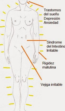 Fibromialgia: diagnóstico, síntomas y tratamientos fibromialgia
