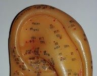 Auriculoterapia: ¿Qué es y para qué sirve?