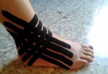 ¿Para qué sirve el vendaje neuromuscular? vendaje neuromuscular