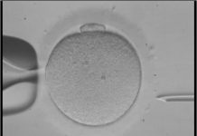 No me quedo embarazada Reproducción asistida.