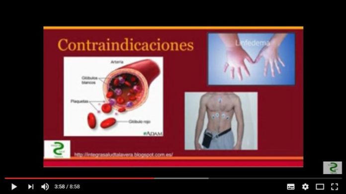 Vídeo sobre Acupuntura Vídeo sobre Acupuntura