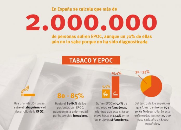 Infografía sobre EPOC Infografía sobre EPOC