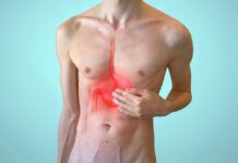 Acupuntura y gastritis gastritis