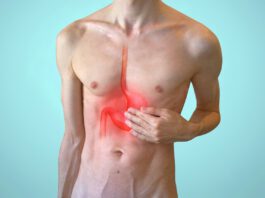 gastritis