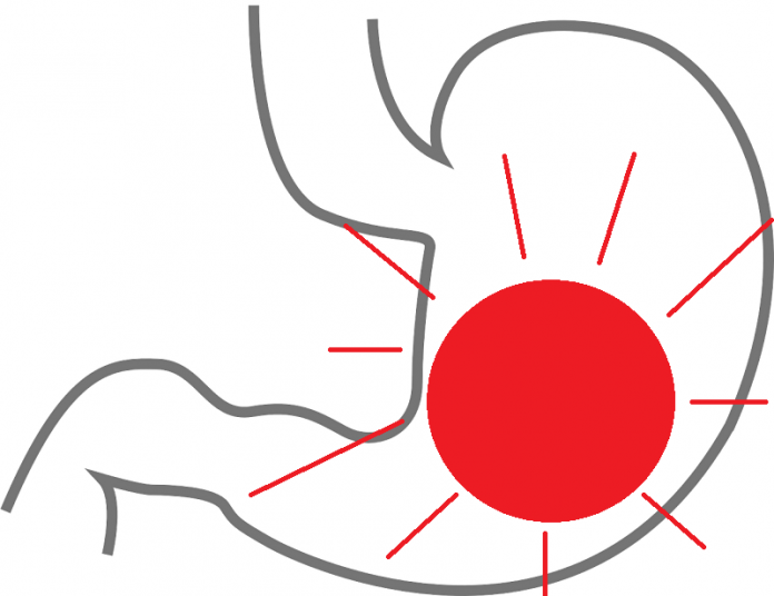 Dolor de estómago Estómago con punto rojo
