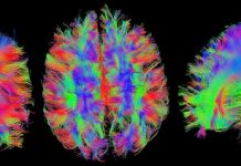 ¿Qué es la neuropsicología? neuropsicología Resonancia magnética del cerebro