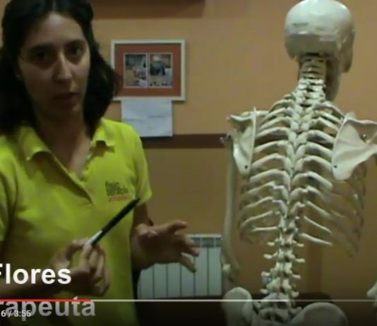 Escoliosis, síntomas y tratamiento Qué es la escoliosis