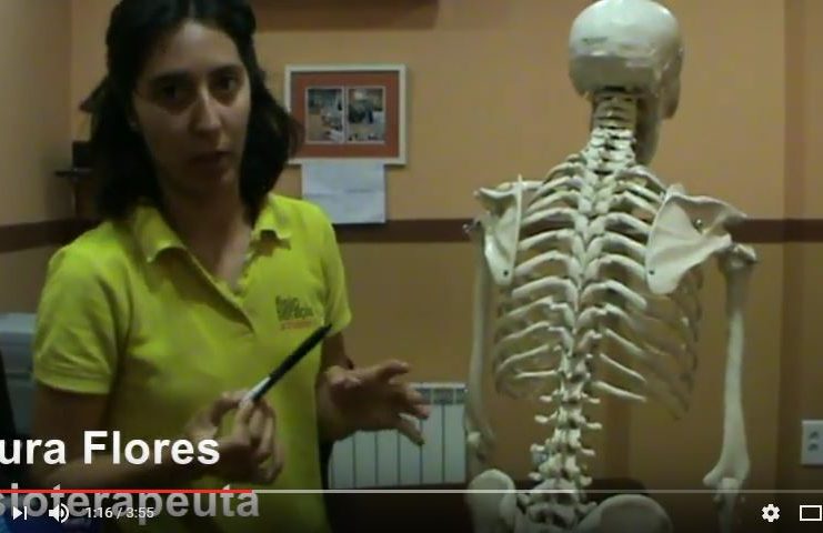 Escoliosis, síntomas y tratamiento Qué es la escoliosis