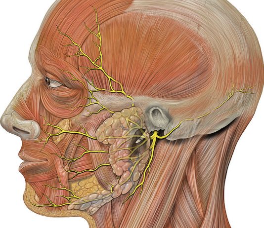 Nervio facial, parálisis facial