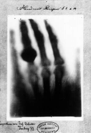 Primera radiografía