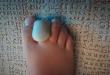 ¿Cómo y cuándo usar una órtesis? ortesis dedo pie