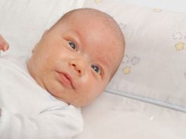 Estrabismo funcional recién nacido