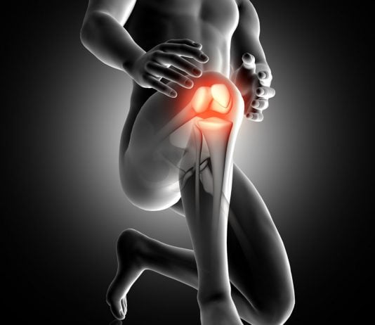 condromalacia rotuliana