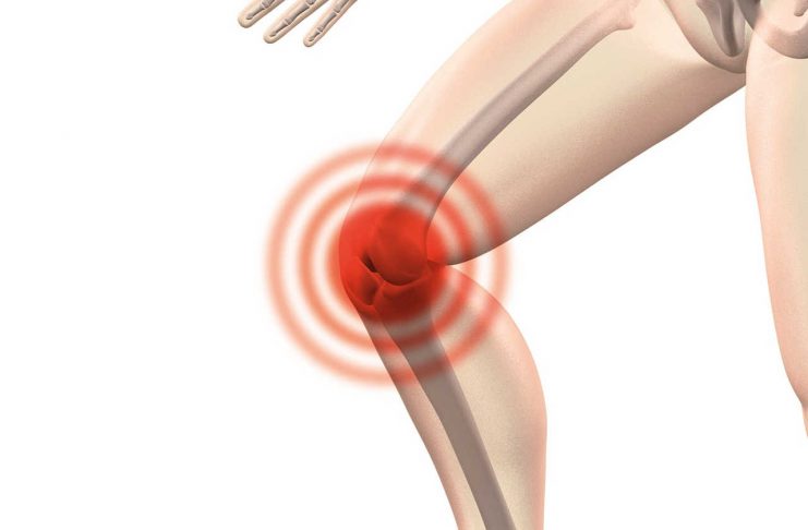 Rotura de ligamento cruzado anterior