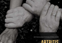 Artritis Reumatoide artritis reumatoide