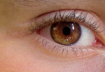 La importancia de mantener una buena higiene del párpado párpados blefaritis