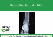 Rehabilitación de tobillo tras cirugía rehabilitación tobillo Fisioterapia Athenea