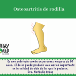 osteoartritis de rodilla