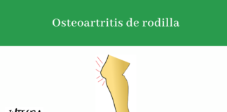osteoartritis de rodilla