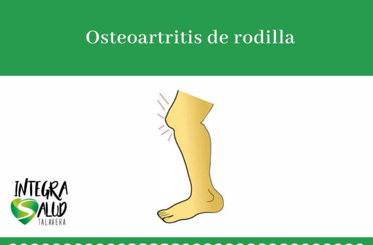 osteoartritis de rodilla